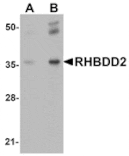 Western blot - RHBDD2 Antibody from Signalway Antibody (25021) - Antibodies.com