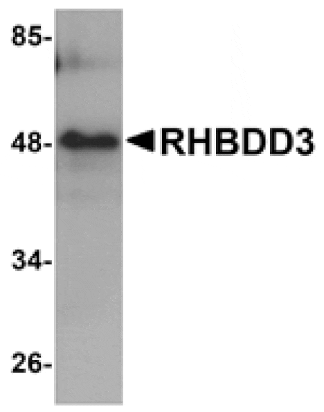 Western blot - RHBDD3 Antibody from Signalway Antibody (25022) - Antibodies.com