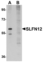 Western blot analysis of SLFN12 in SK-N-SH cell lysate with SLFN12 antibody at 1 µg/mL in (A) the absence and (B) the presence of blocking peptide.