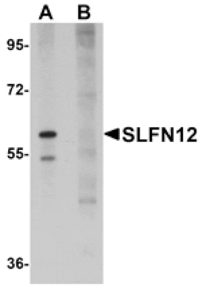 Western blot - SLFN12 Antibody from Signalway Antibody (25024) - Antibodies.com