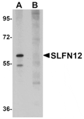Western blot - SLFN12 Antibody from Signalway Antibody (25024) - Antibodies.com