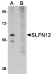 Western blot - SLFN12 Antibody from Signalway Antibody (25024) - Antibodies.com