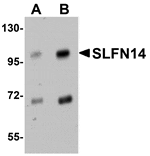 Western blot analysis of SLFN14 in mouse kidney tissue lysate with SLFN14 antibody at (A) 1 and (B) 2 µg/mL.