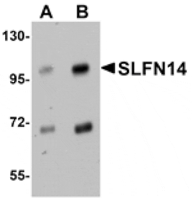 Western blot - SLFN14 Antibody from Signalway Antibody (25025) - Antibodies.com