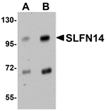 Western blot - SLFN14 Antibody from Signalway Antibody (25025) - Antibodies.com