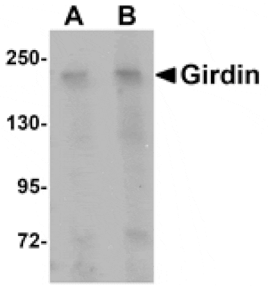 Western blot - Girdin Antibody from Signalway Antibody (25026) - Antibodies.com