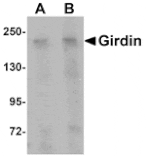 Western blot - Girdin Antibody from Signalway Antibody (25026) - Antibodies.com