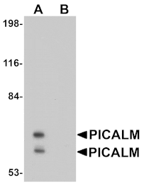 Western blot - PICALM Antibody from Signalway Antibody (25029) - Antibodies.com