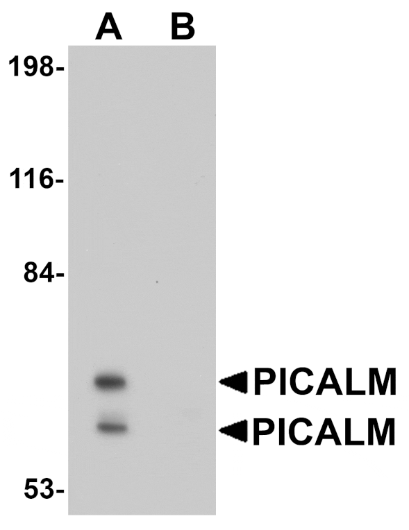 Western blot - PICALM Antibody from Signalway Antibody (25029) - Antibodies.com