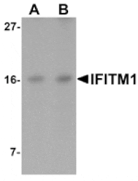 Western blot - IFITM1 Antibody from Signalway Antibody (25135) - Antibodies.com