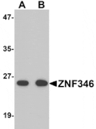 Western blot - ZNF346 Antibody from Signalway Antibody (25200) - Antibodies.com