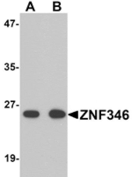Western blot - ZNF346 Antibody from Signalway Antibody (25200) - Antibodies.com