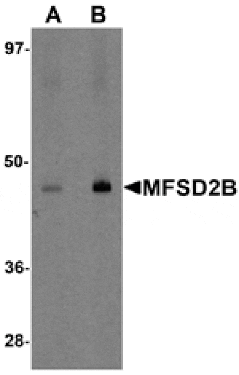 Western blot - MFSD2B Antibody from Signalway Antibody (25209) - Antibodies.com
