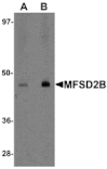 Western blot - MFSD2B Antibody from Signalway Antibody (25209) - Antibodies.com