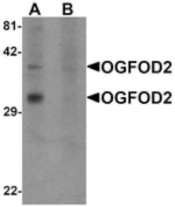 Western blot - OGFOD2 Antibody from Signalway Antibody (25261) - Antibodies.com