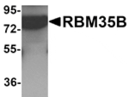 Western blot - RBM35B Antibody from Signalway Antibody (25265) - Antibodies.com