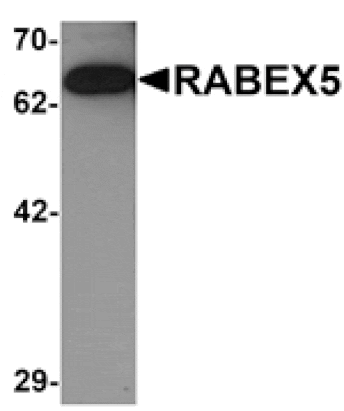 Western blot - RABEX5 Antibody from Signalway Antibody (25276) - Antibodies.com