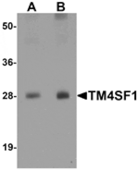 Western blot - TM4SF1 Antibody from Signalway Antibody (25278) - Antibodies.com