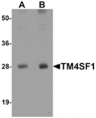 Western blot - TM4SF1 Antibody from Signalway Antibody (25278) - Antibodies.com