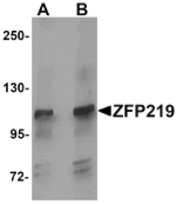 Western blot - ZFP219 Antibody from Signalway Antibody (25279) - Antibodies.com