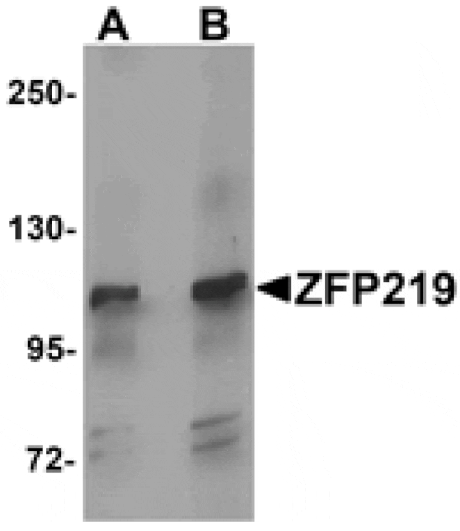 Western blot - ZFP219 Antibody from Signalway Antibody (25279) - Antibodies.com