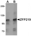 Western blot - ZFP219 Antibody from Signalway Antibody (25279) - Antibodies.com