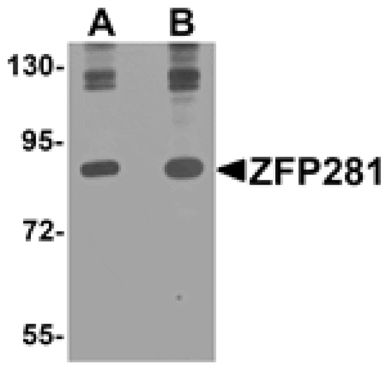 Western blot - ZFP281 Antibody from Signalway Antibody (25280) - Antibodies.com