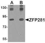 Western blot - ZFP281 Antibody from Signalway Antibody (25280) - Antibodies.com