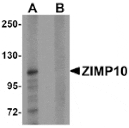 Western blot - ZIMP10 Antibody from Signalway Antibody (25282) - Antibodies.com