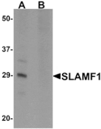 Western blot - SLAMF1 Antibody from Signalway Antibody (25284) - Antibodies.com