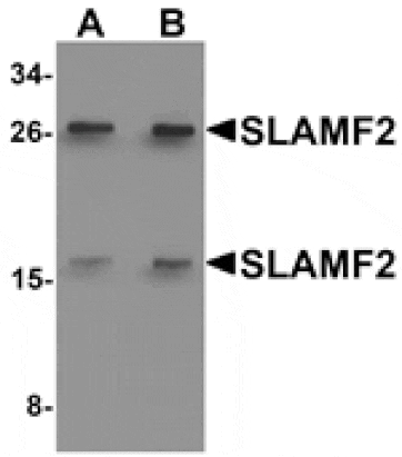 Western blot - SLAMF2 Antibody from Signalway Antibody (25285) - Antibodies.com