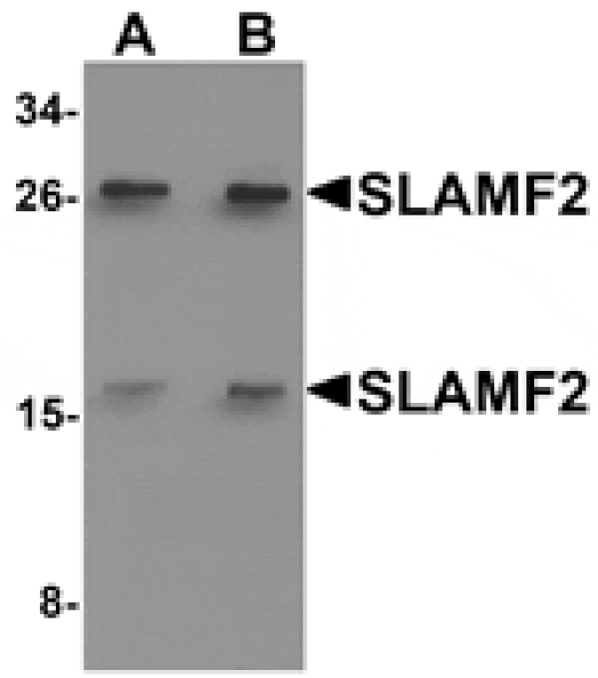 Western blot - SLAMF2 Antibody from Signalway Antibody (25285) - Antibodies.com
