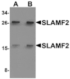 Western blot - SLAMF2 Antibody from Signalway Antibody (25285) - Antibodies.com