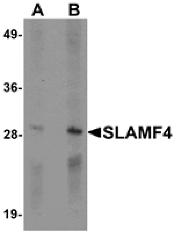 Western blot - SLAMF4 Antibody from Signalway Antibody (25287) - Antibodies.com