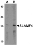 Western blot - SLAMF4 Antibody from Signalway Antibody (25287) - Antibodies.com