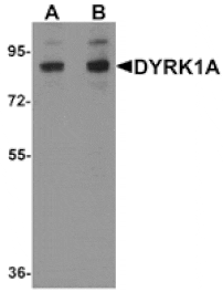 Western blot - DYRK1A Antibody from Signalway Antibody (25288) - Antibodies.com