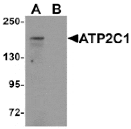 Western blot - ATP2C1 Antibody from Signalway Antibody (25295) - Antibodies.com
