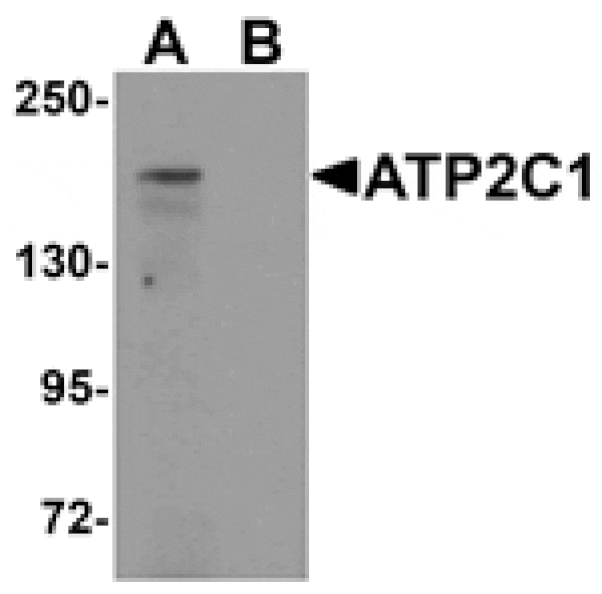 Western blot - ATP2C1 Antibody from Signalway Antibody (25295) - Antibodies.com