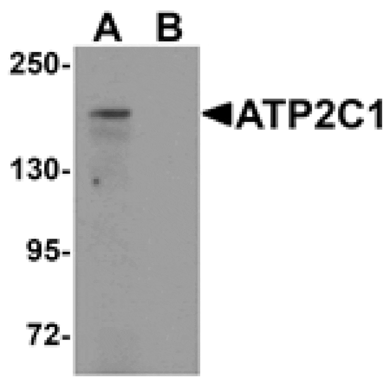 Western blot - ATP2C1 Antibody from Signalway Antibody (25295) - Antibodies.com