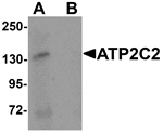 Western blot analysis of ATP2C2 in 3T3 cell lysate with ATP2C2 antibody at 1 µg/mL in (A) the absence and (B) the presence of blocking peptide