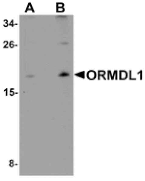 Western blot - ORMDL1 Antibody from Signalway Antibody (25308) - Antibodies.com