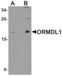 Western blot - ORMDL1 Antibody from Signalway Antibody (25308) - Antibodies.com