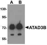 Western blot analysis of ATAD3B in human kidney tissue lysate with ATAD3B antibody at (A) 1 and (B) 2 µg/mL .