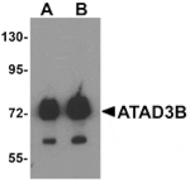 Western blot - ATAD3B Antibody from Signalway Antibody (25322) - Antibodies.com