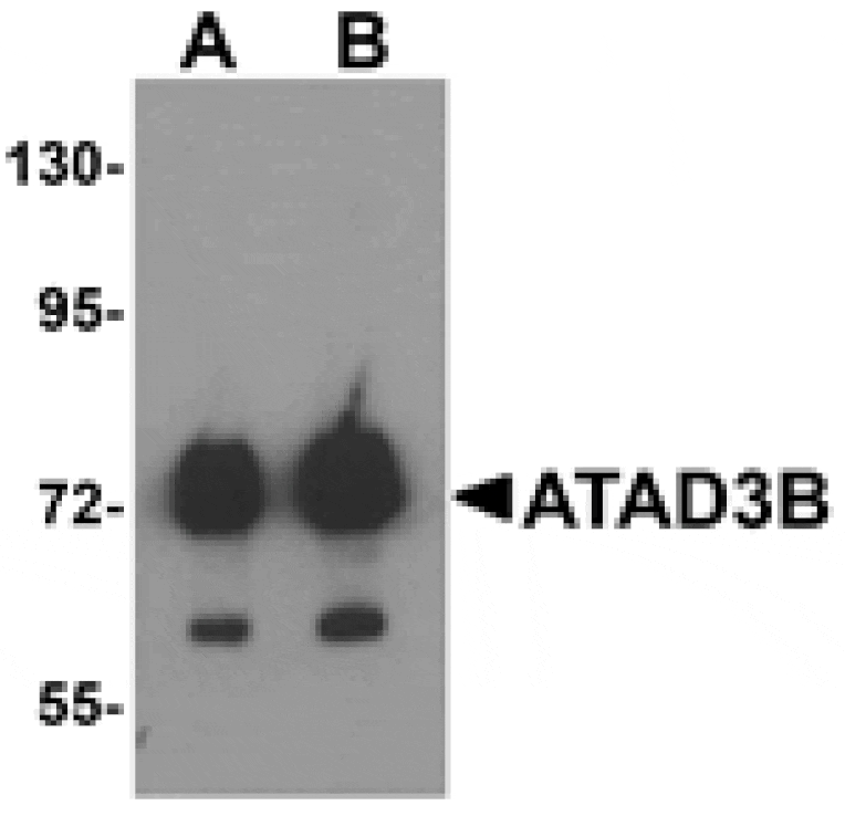 Western blot - ATAD3B Antibody from Signalway Antibody (25322) - Antibodies.com