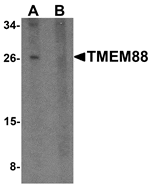 Western blot analysis of TMEM88 in human brain tissue lysate with TMEM88 antibody at 1 µg/mL in (A) the absence and (B) the presence of blocking peptide.