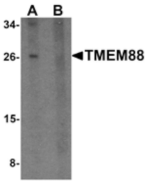 Western blot - TMEM88 Antibody from Signalway Antibody (25326) - Antibodies.com