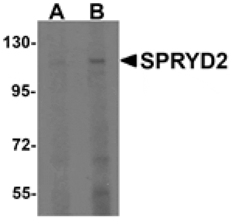 Western blot - SPRYD2 Antibody from Signalway Antibody (25328) - Antibodies.com