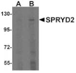 Western blot - SPRYD2 Antibody from Signalway Antibody (25328) - Antibodies.com