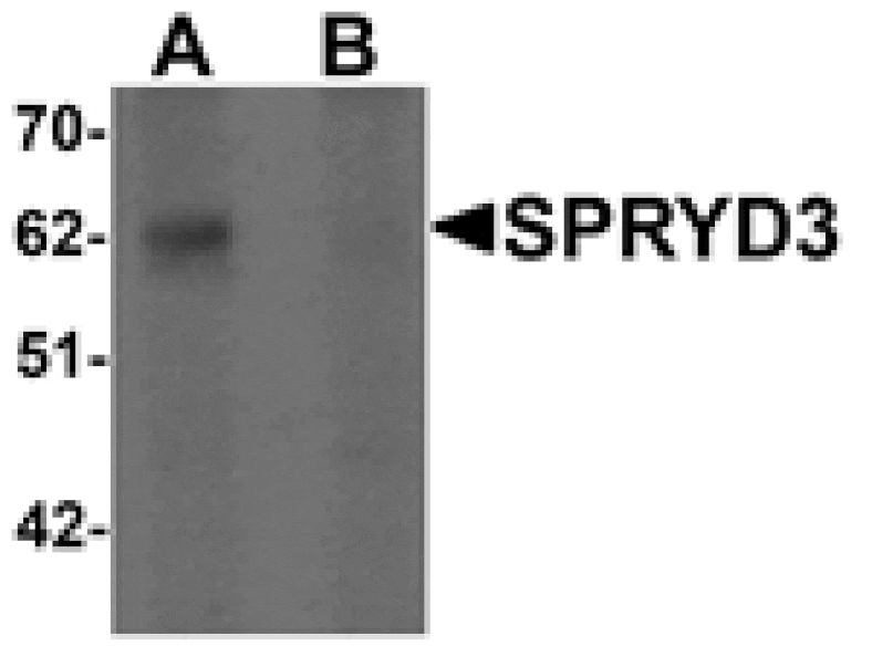 Western blot - SPRYD3 Antibody from Signalway Antibody (25329) - Antibodies.com